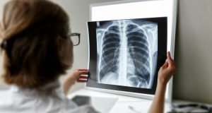 Popcorn Lung: Separating Myth From Science 